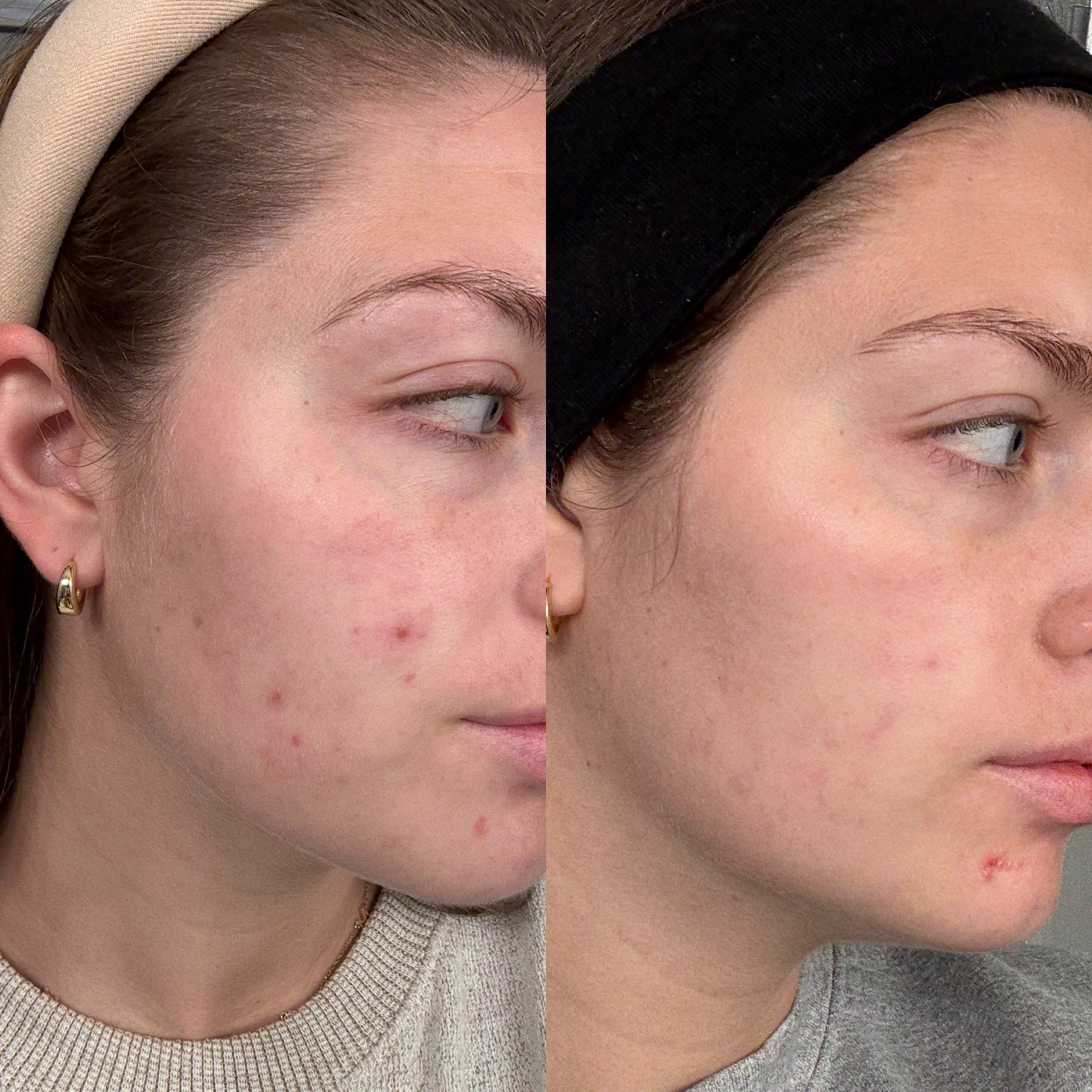 Golden Barrier Support Serum