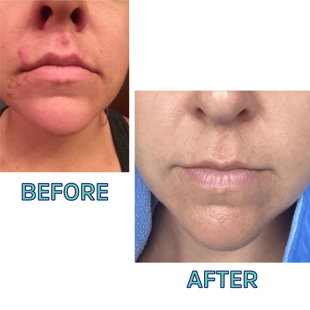 Cleansing Oil For Dry Skin 4 Oz - My American Goods