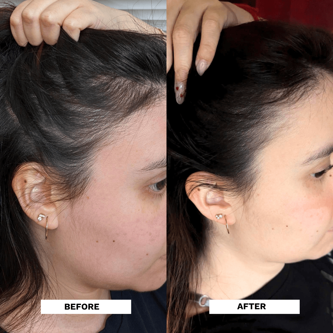 Evatasha Hair Care Restore Hair Recovery Tonic