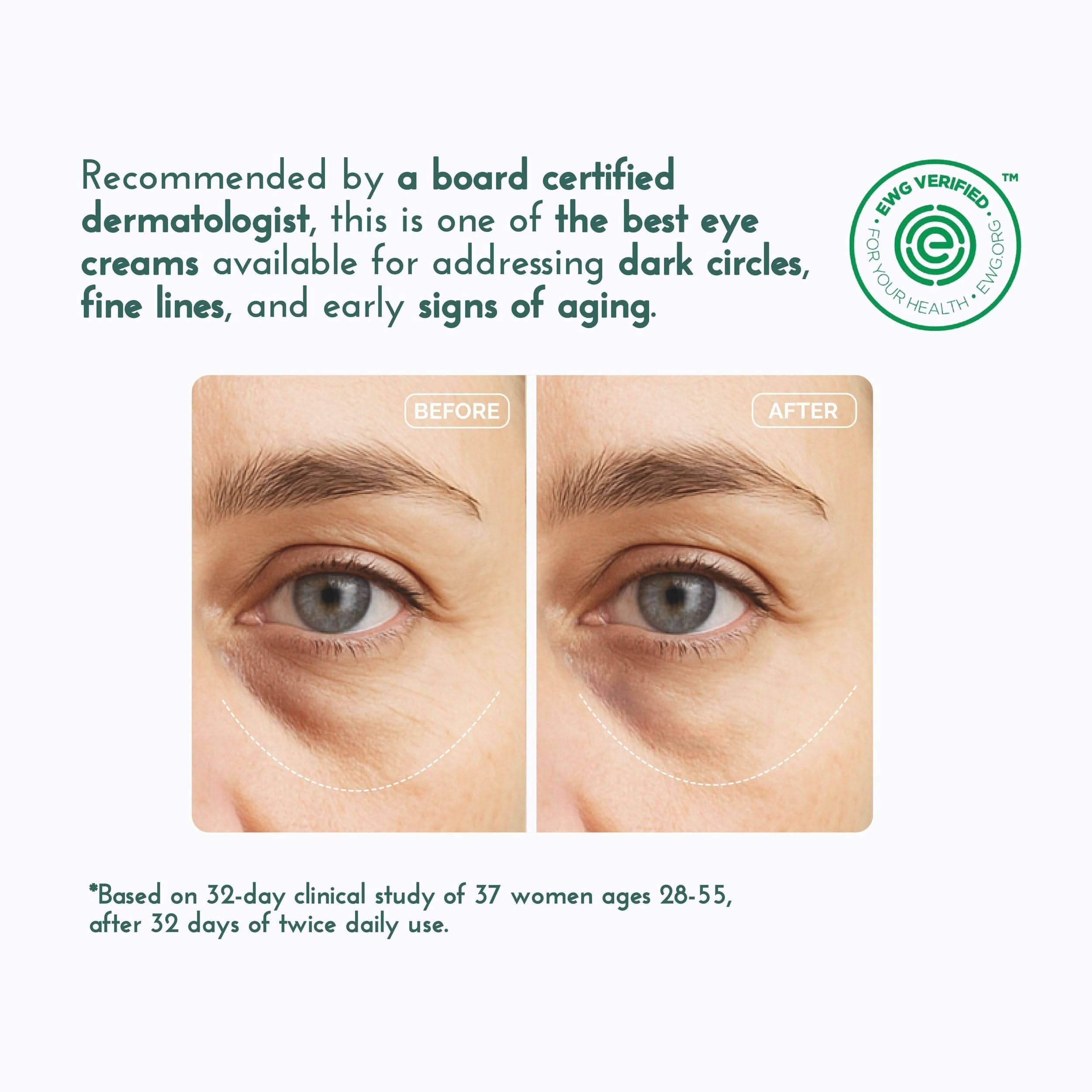 Before and after eye cream application showing reduced dark circles and fine lines.