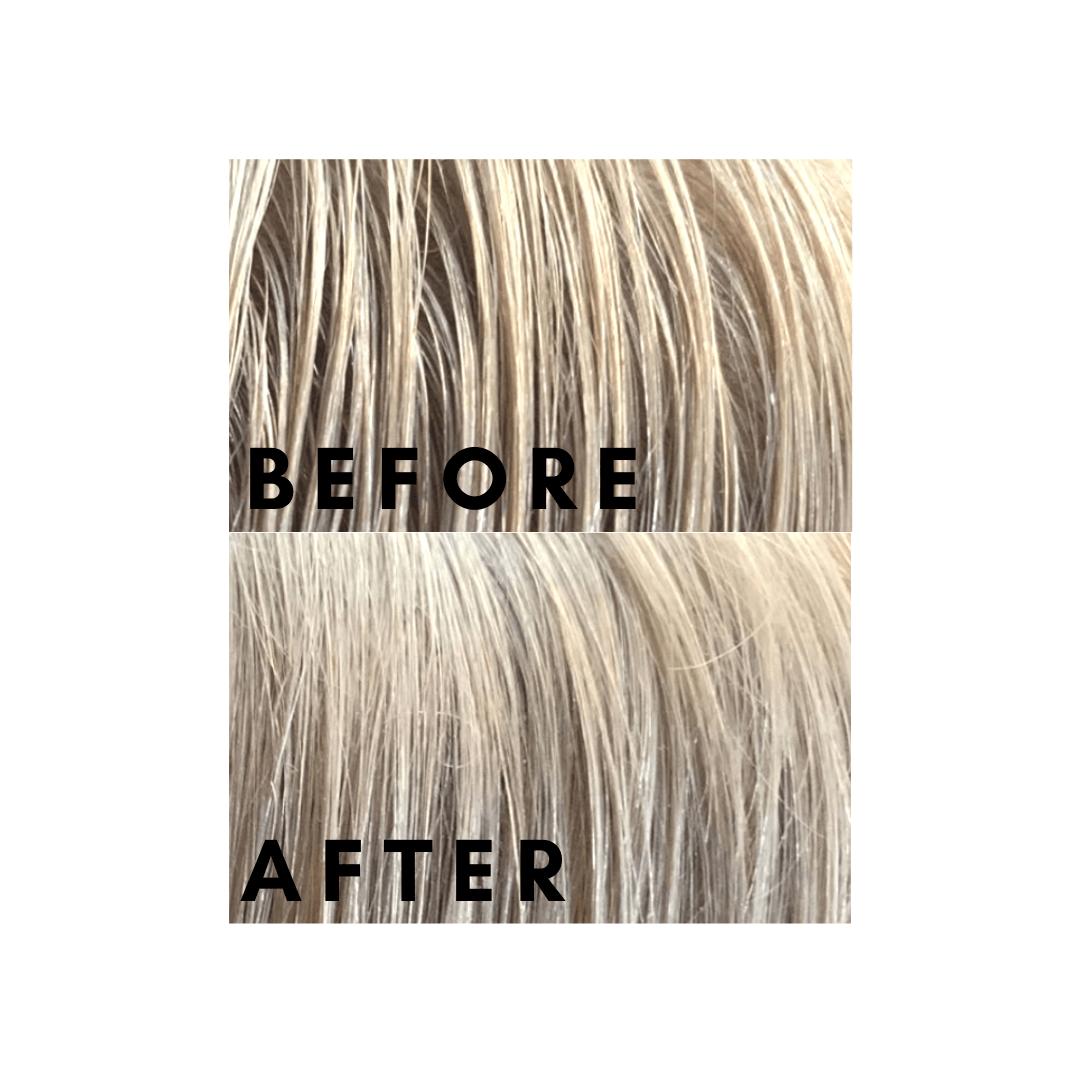Carter + Jane Fix Scalpfix™