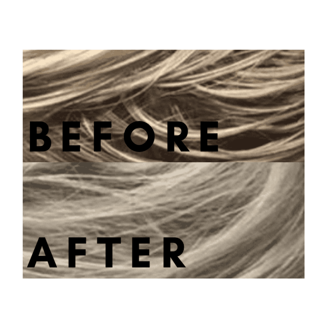 Carter + Jane Fix Scalpfix™