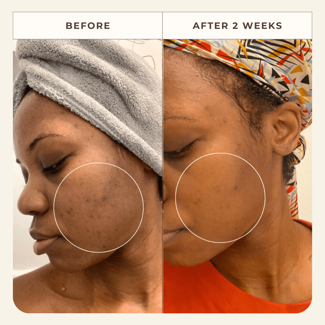 Apoterra Toner Neroli Clarifying Complexion Mist
