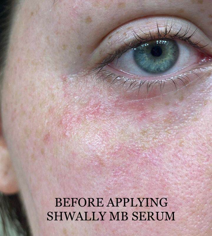 Methylene Blue Repair Serums - My American Goods