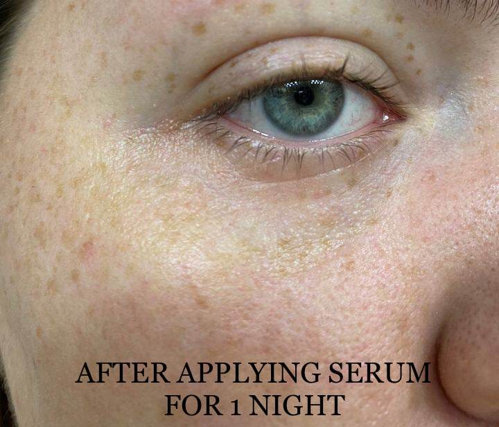 Methylene Blue Repair Serums - My American Goods