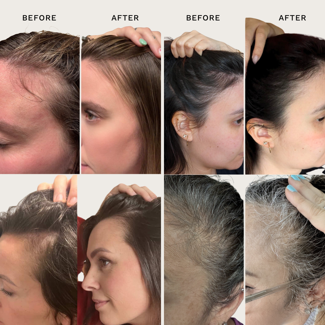 Hair Renewal Bundle