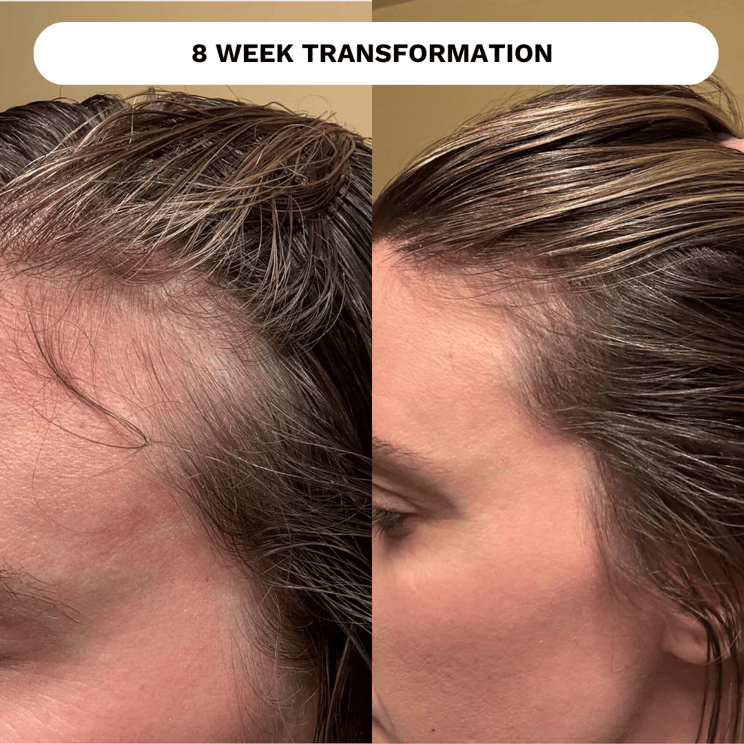 Evatasha Hair Care Restore Hair Recovery Tonic