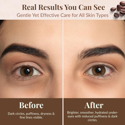 Tallow Eye Cream | Coffee Infused Under Eye Cream 2 oz