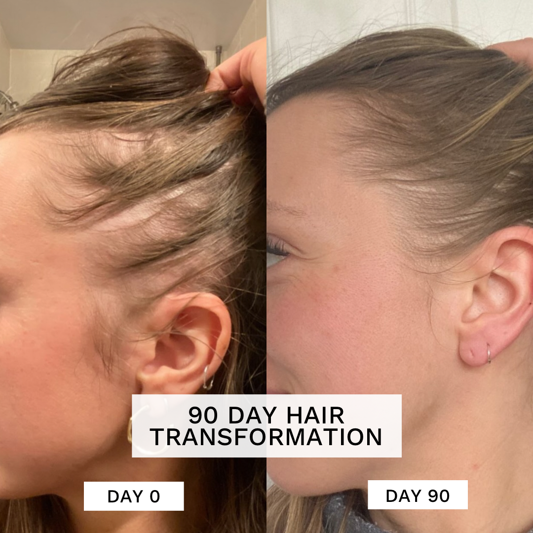 Hair Renewal Bundle