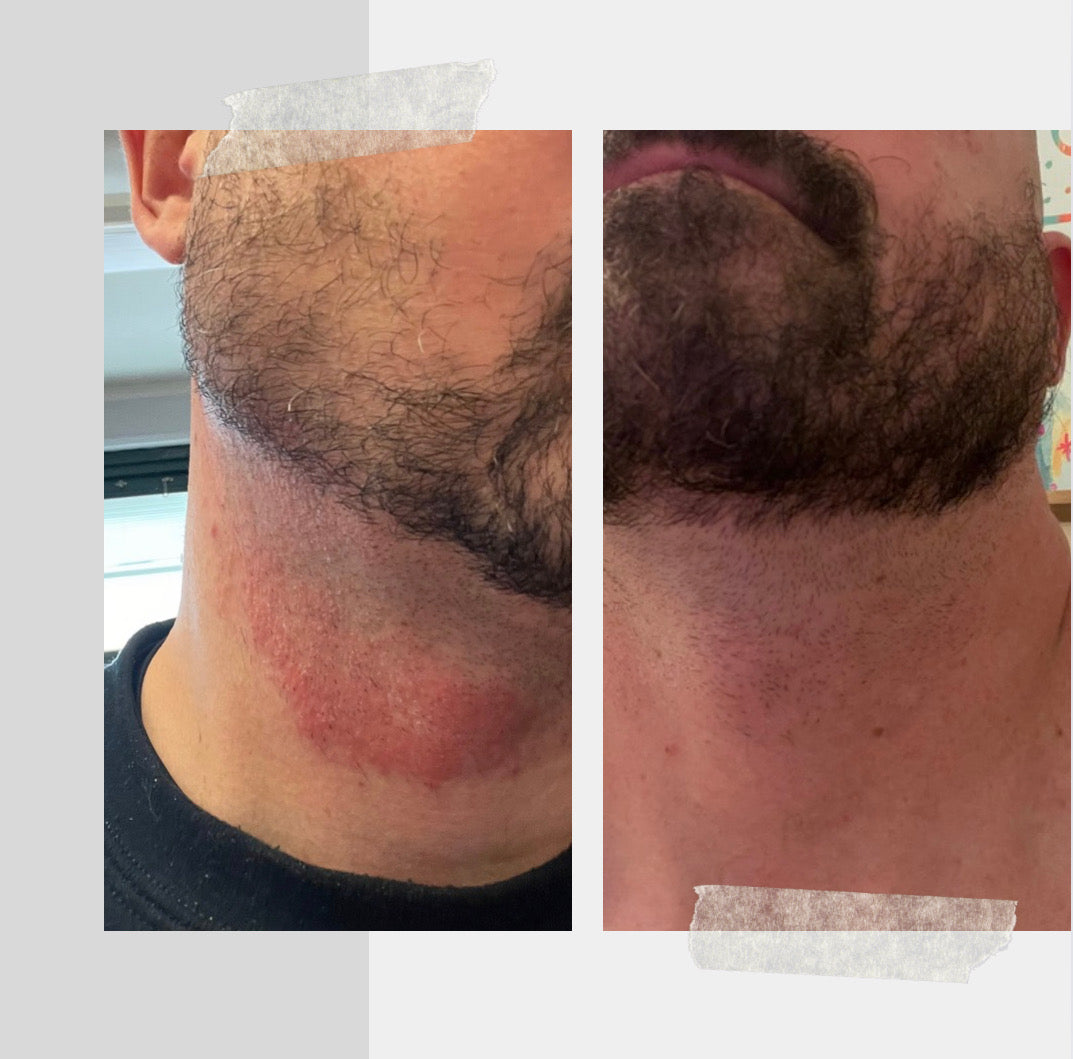 Hydrating Face Butter with Essential Oils - My American Goods