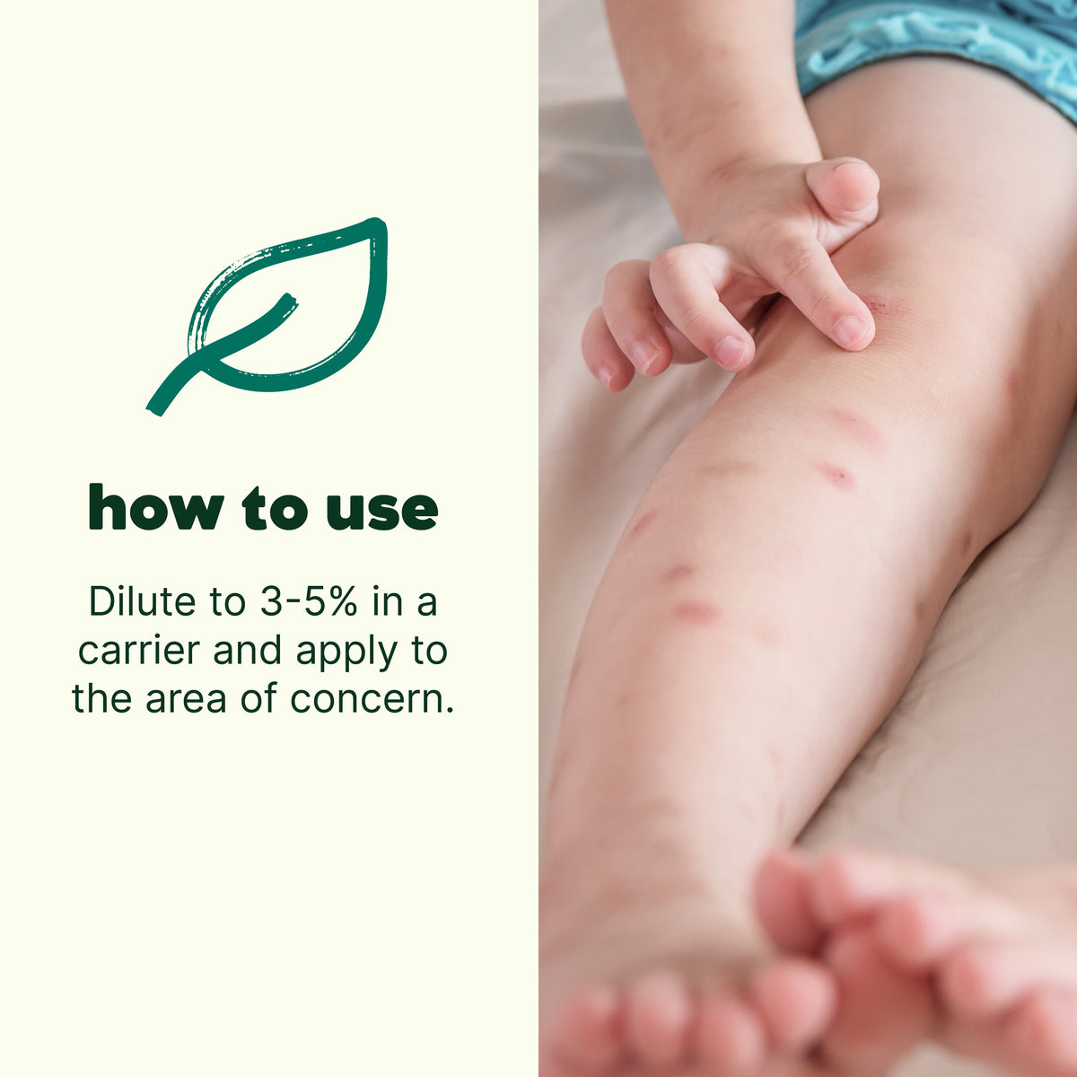 Itch Away Essential Oil