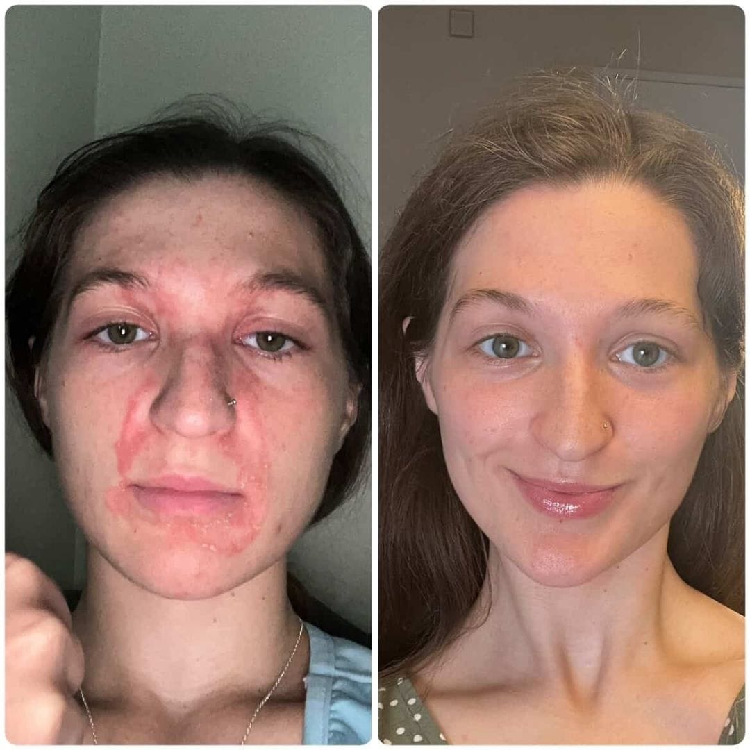 Evatasha Skincare Normal to Dry Skin Starter Kit