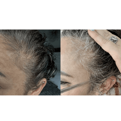Evatasha Hair Care Hair Renewal Bundle