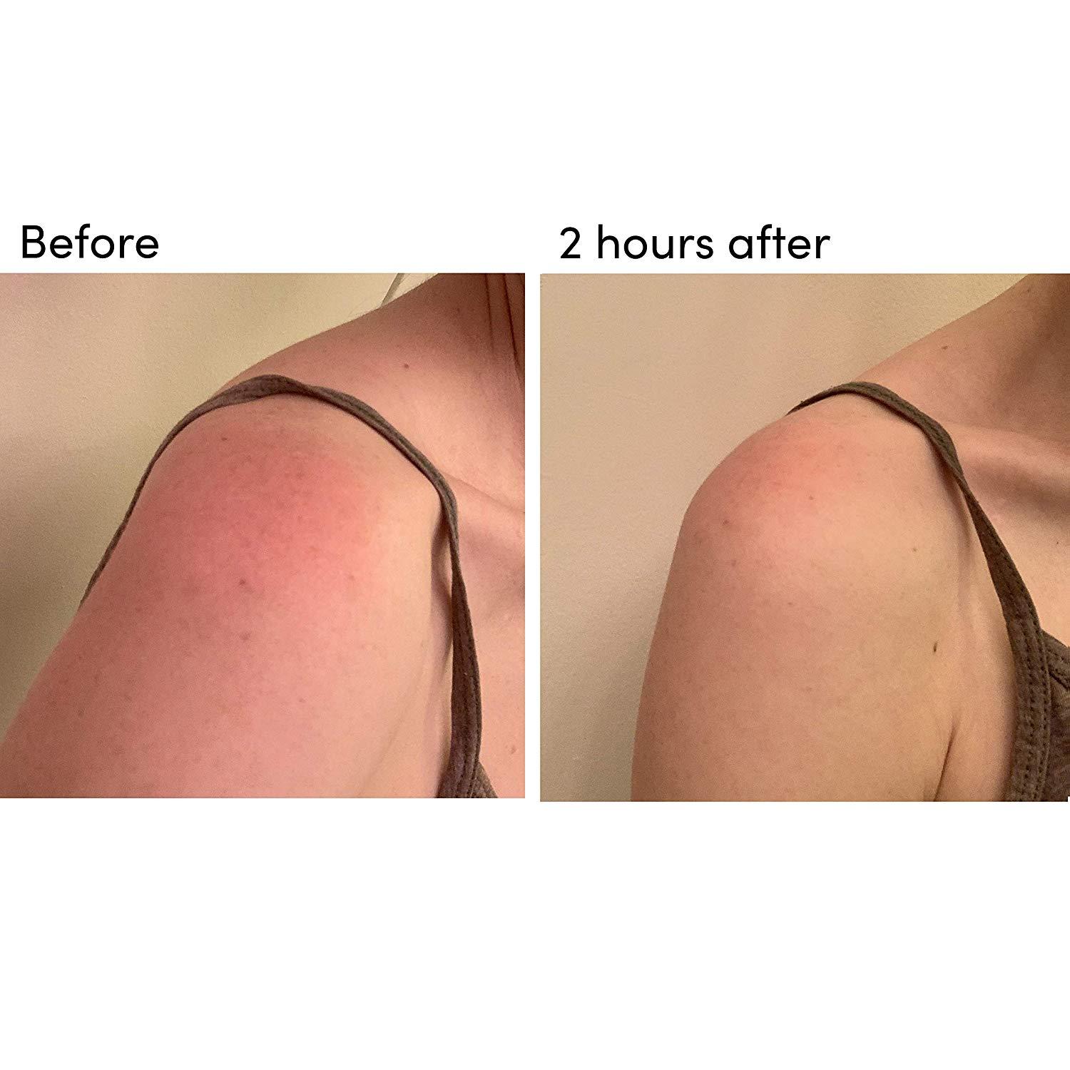 RECESS body wipe BODY 301: After-Sun Aloe Wipes (Pack of 15)