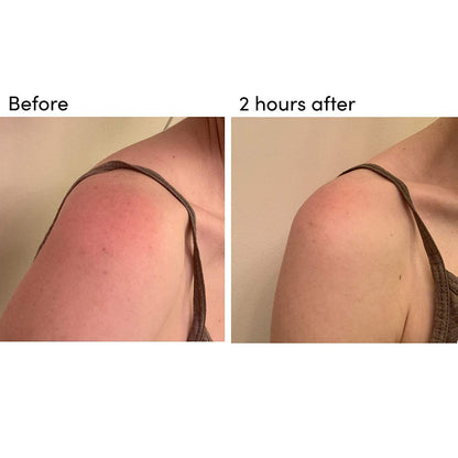 BODY 301: After-Sun Aloe Wipes (Pack of 15)