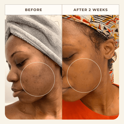 Neroli Clarifying Complexion Mist