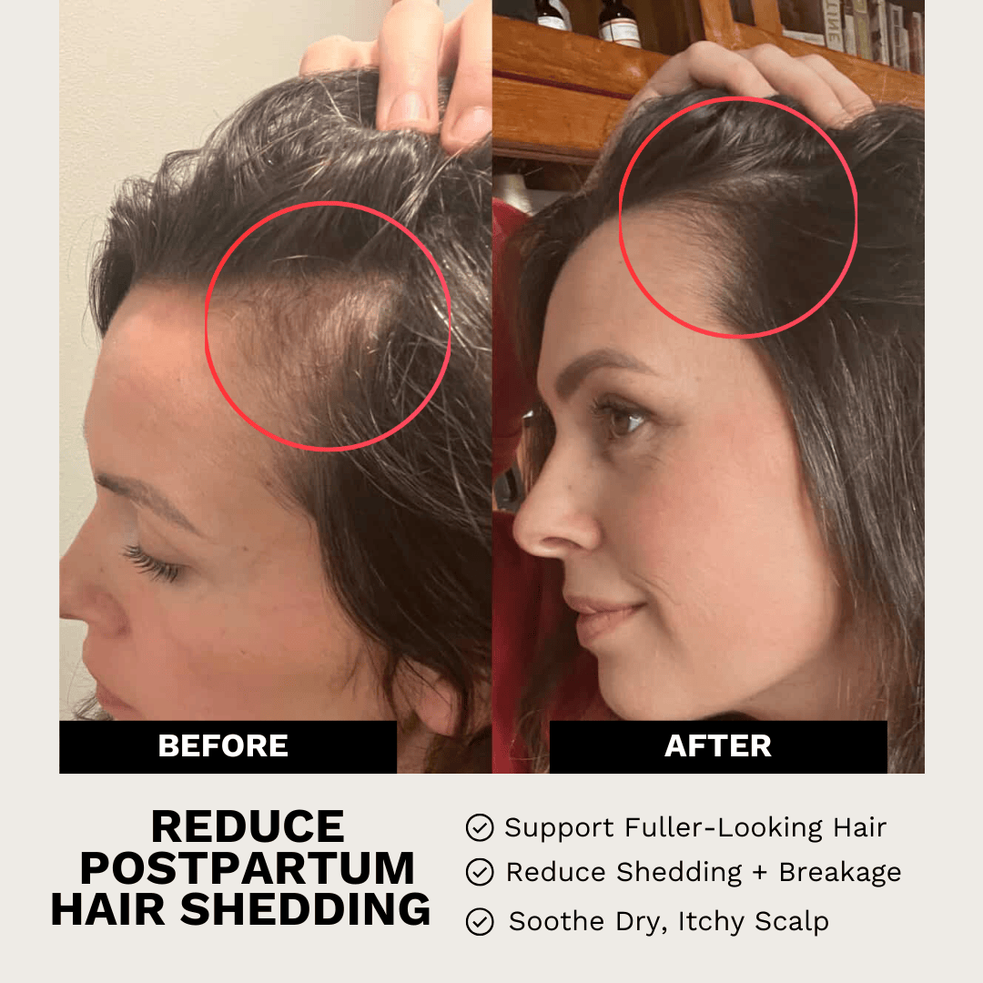 Evatasha Hair Care Hair Renewal Bundle
