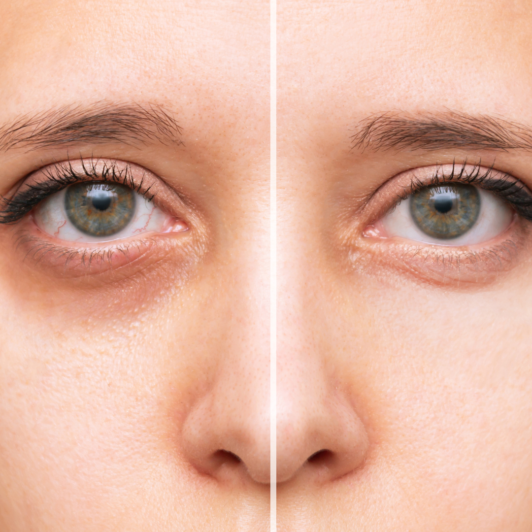 Under-Eye Color Corrector Concealer | Dark Circles - My American Goods