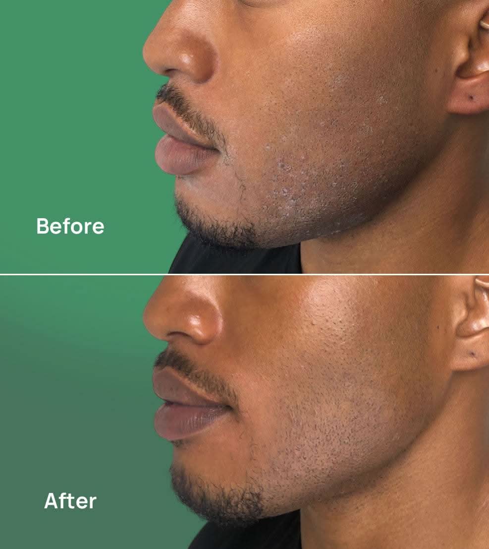 Krete Skincare The One-Two Punch - Facial Cleanser